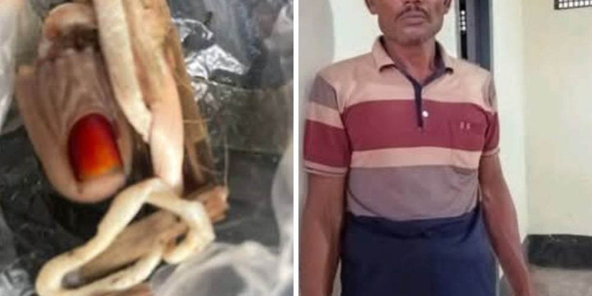 ধর্ষণের চেষ্টায় ব্যর্থ হয়ে নারীর আঙ্গুল কামড়ে ছিড়ে ফেরেছে যুবক..