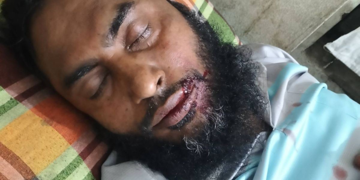 মাদক সেবন বাধা দেওয়ায় হোটেল মালিক কে পিটিয়ে জখম করেছে সন্ত্রাসীরা..