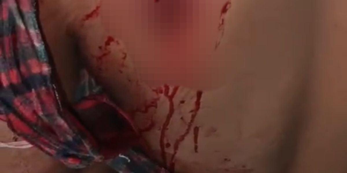 দোয়ারাবাজারে যুবকের ওপর সশস্ত্র হামলা ও ছিনতাইয়ের অভিযোগ,..