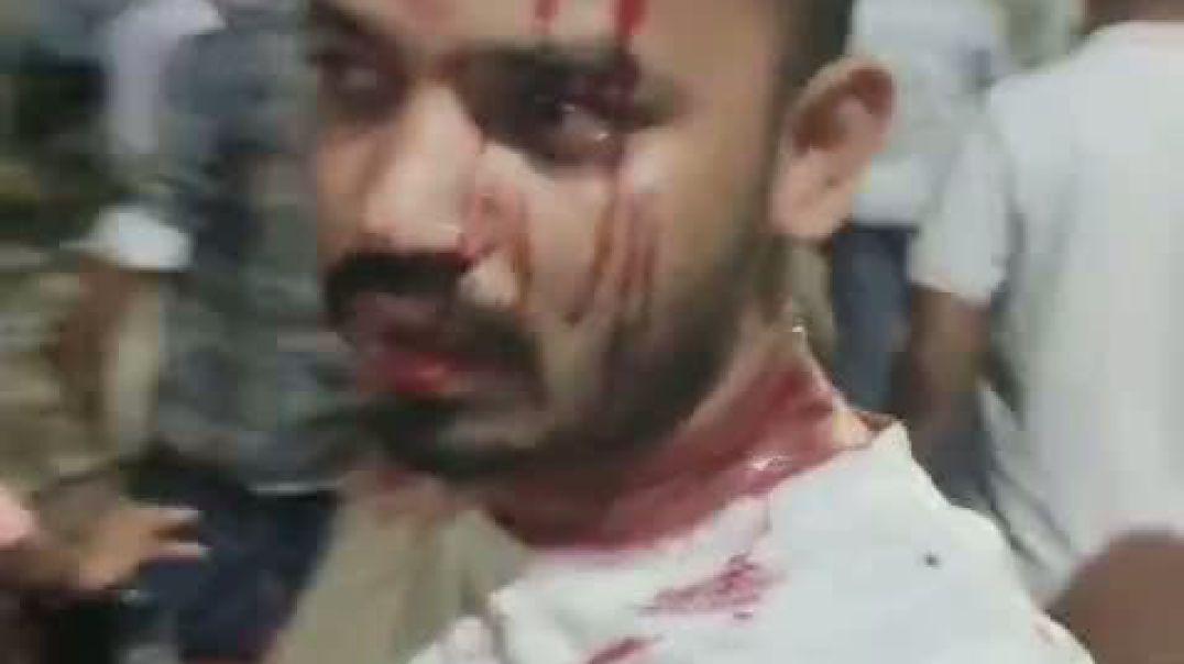 চাঁদাবাজিতে বাঁধা দেওয়ায় নিউমার্কেট যুবদলের সদস্য সচিব চঞ্চলের নেতৃত্বে ঢাকা কলেজ ছাত্রদলের উপর হামল
